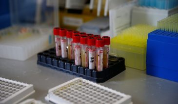 Известие о заражении COVID-19 можно будет узнать через СМС-сообщение